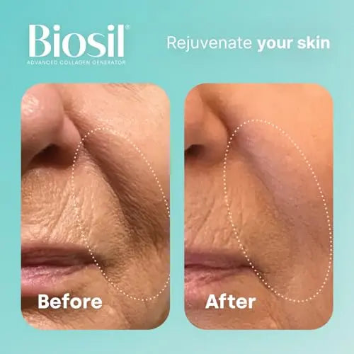 Biosil Collagen Generator - 120 Capsules - with Patented ch-OSA Complex - Generates & Protects BioSil Au supplements