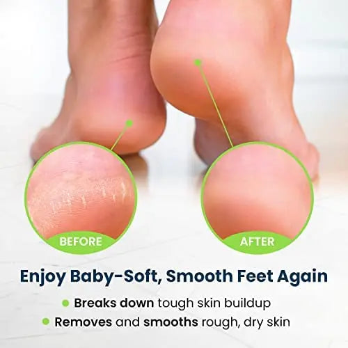 Toenail Fungus Treatment Extra Strength - Advance nail fungus treatment for fingernails FOOT CURE Au supplements