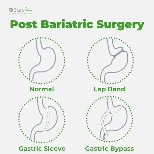 BariSlim Iron Plus Capsules - Formulated for Patients After Weight Loss Surgery Including BariSlim Au supplements