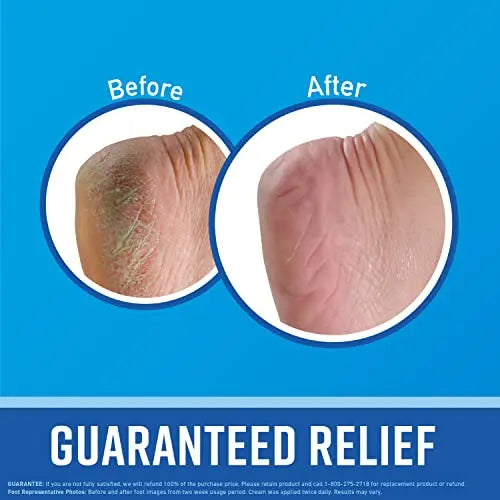 O'Keeffe's for Healthy Feet Foot Cream, 3.0 Ounce Tube and O'Keeffe's for Healthy Feet O'Keeffe's Au supplements