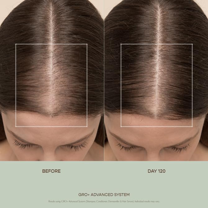 VEGAMOUR GRO+ Advanced Essentials Kit | Removes Buildup, Improves Hair Density, Reduces Shedding, Hydrates and Exfoliates the Scalp | For Severe Signs of Thinning | Color Safe, Vegan, Cruelty-Free VEGAMOUR Au supplements