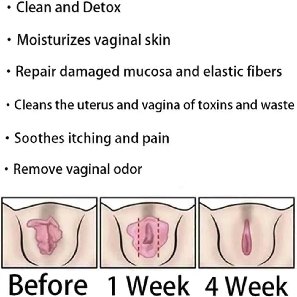AnnieCare Instant Anti-Itch Detox Products, Annie Care Capsulas, Firming Repair & Pink Weabet Au supplements