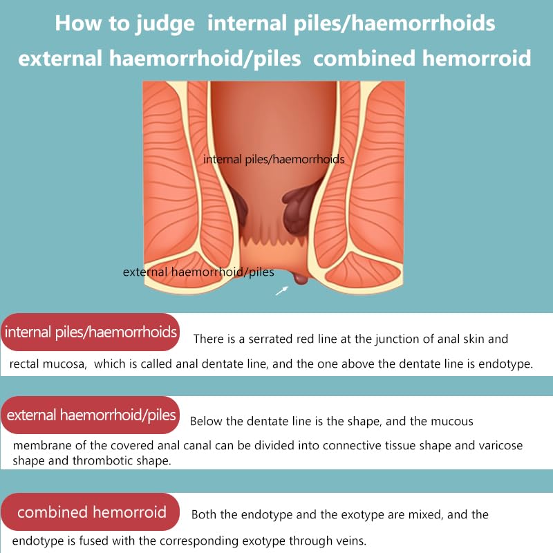SERYNTH Hemorrhoid and Anal Fissure Ointment, Hemorrhoid Treatment, Fast Relief from Swelling, Pain, Itching, Burning (20g) SERYNTH Au supplements