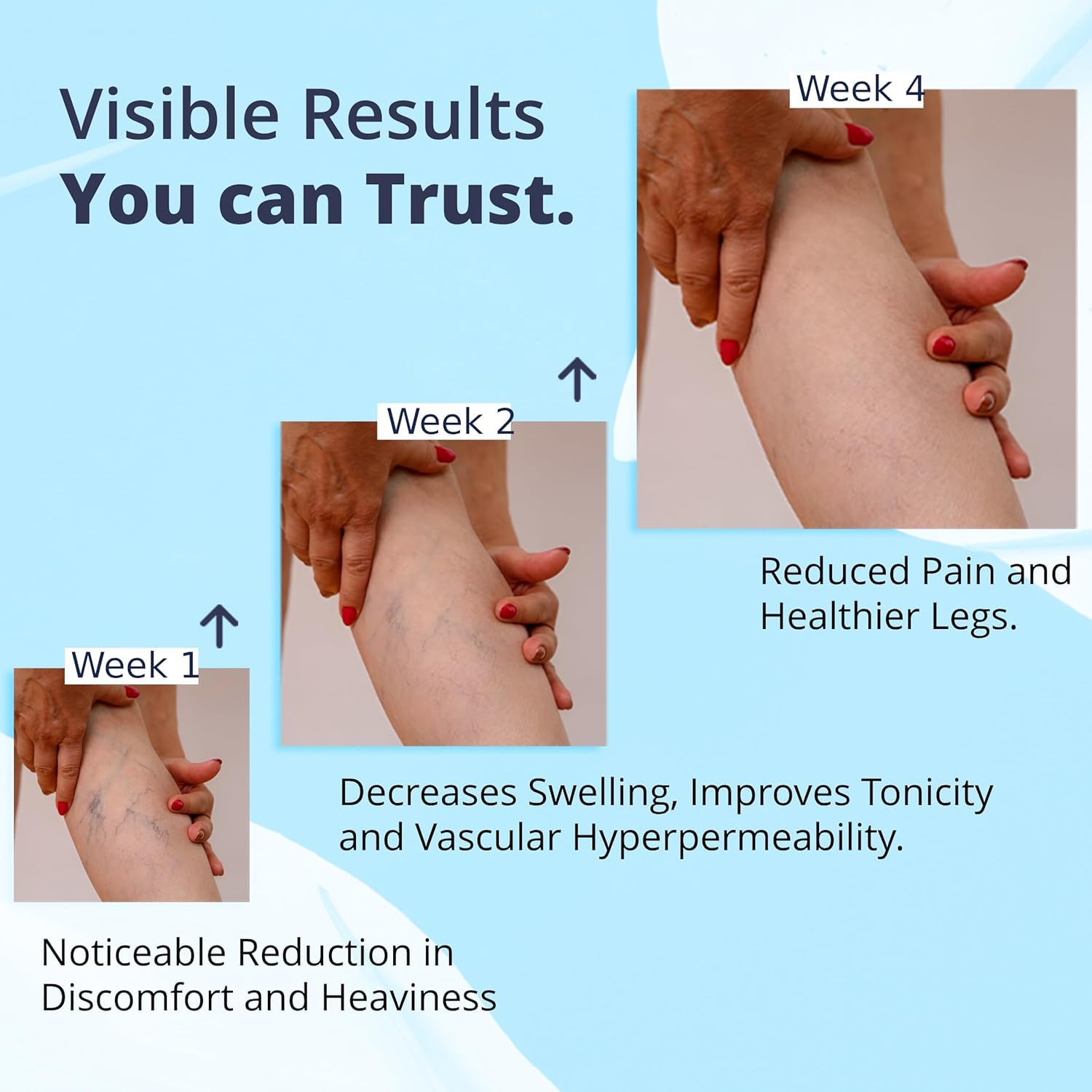Cream Ayurvedic Solution for Management of Varicose Veins, Spider Veins, Varicocele Helps Reach The Root Cause of varicose Veins Reduces Cramps, Itching & Swelling. Single Tube (25 GMS). Generic Au supplements