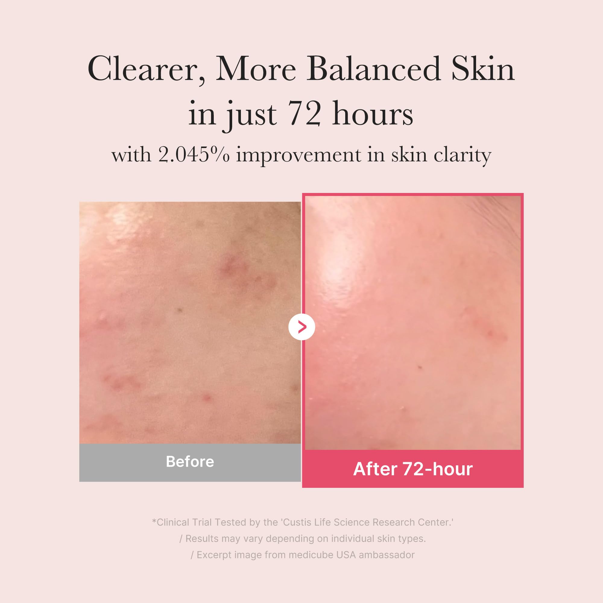 medicube TXA+Niacinamide 15% Glow Facial Serum for After Spot Care | All-in-One Daily