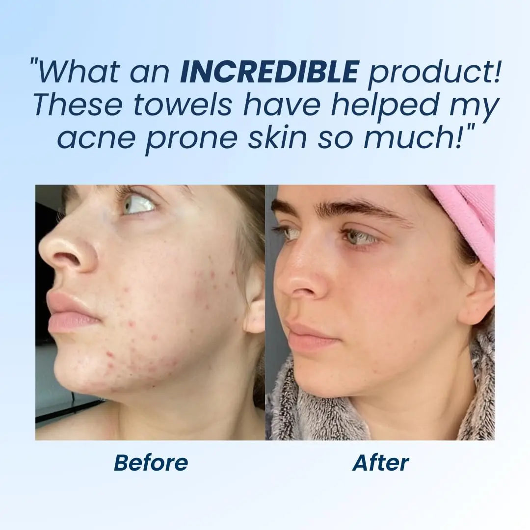 Clean Skin Club Clean Towels XL, 100% USDA Biobased Dermatologist Appr CLEAN SKIN CLUB Au supplements