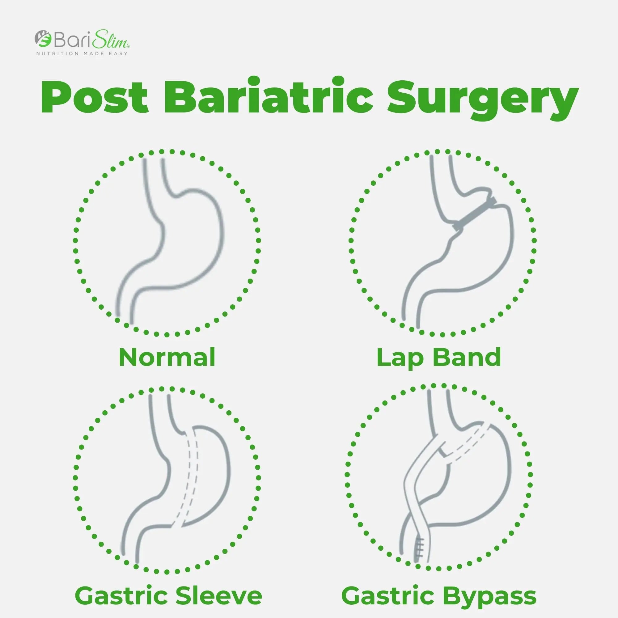 BariSlim Bariatric Calcium Citrate Plus Powder - Formulated for Patients After Weight Loss BariSlim Au supplements