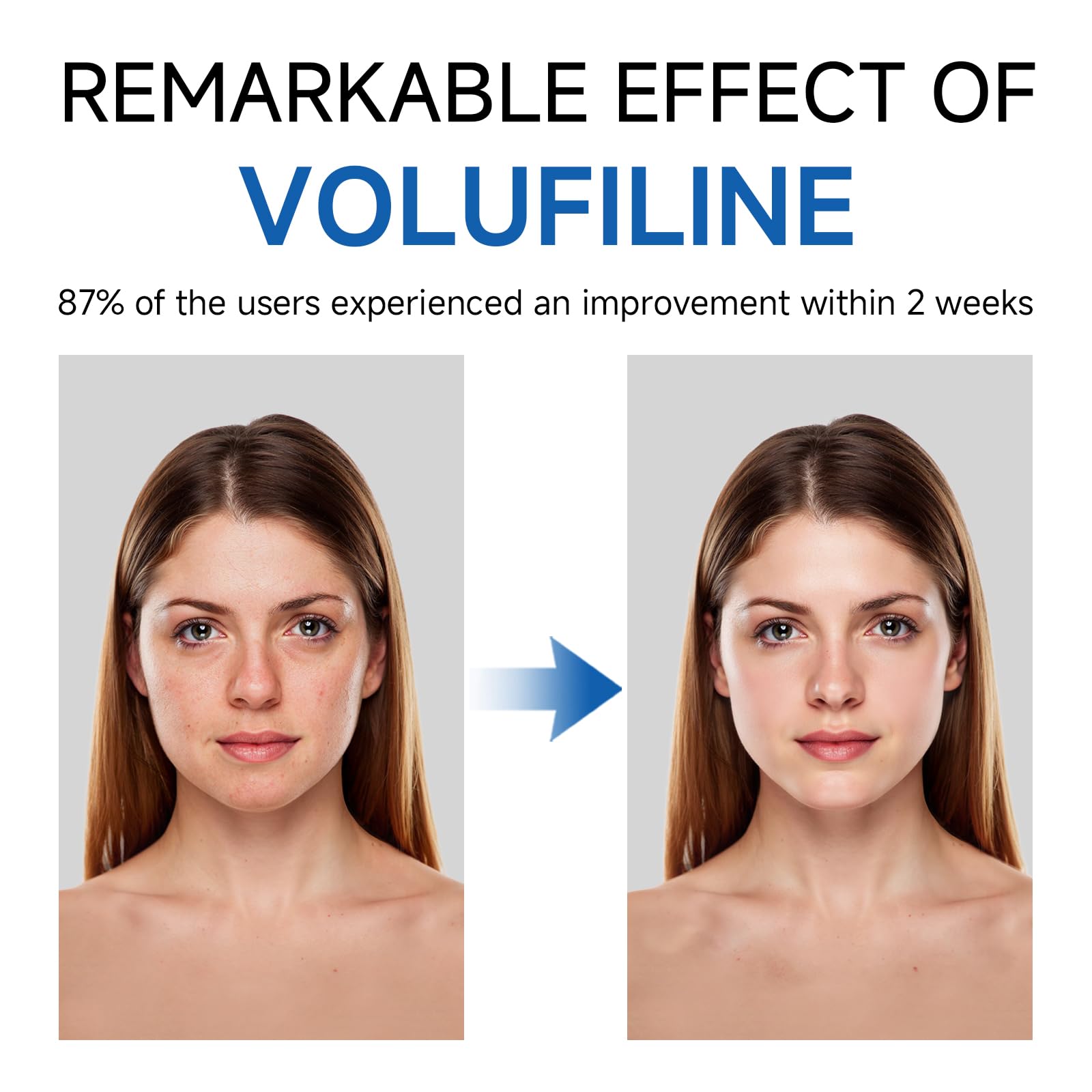 Volufiline Serum, Volufiline Under Eye Serum, Cosmetic Grade Ampoule for Skin Elasticity Improvement, Face & Body Fine Lines, Hydrating Texture, 10ml*2 GUDE GUDE Au supplements