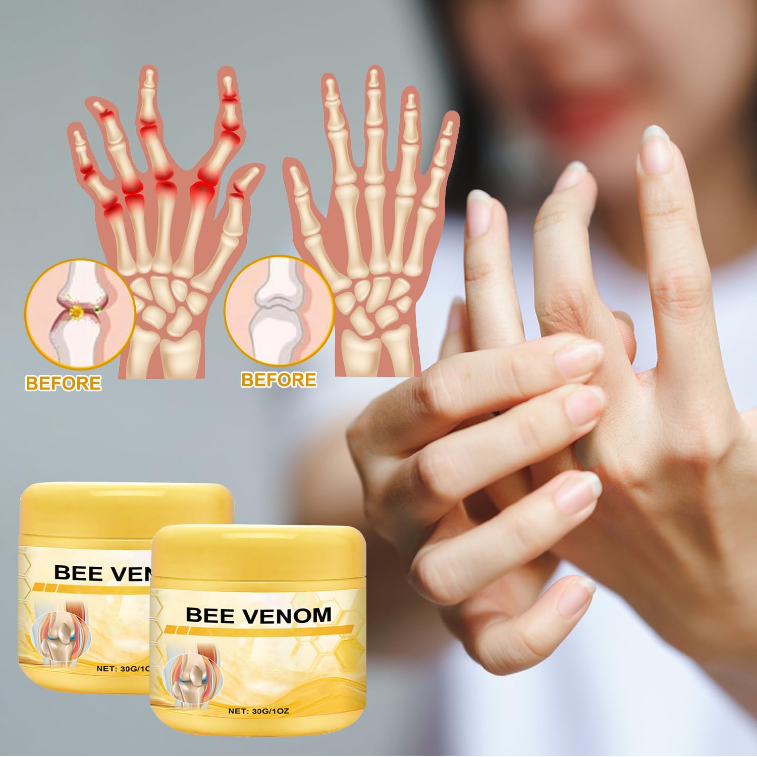 Botou 2PCS New Bee Venom Professional Joint Cream, for Neck, Waist, Back, Hands, Feet and Legs Advanced Bee Propolis Joint Cream, yellow Botou Au supplements
