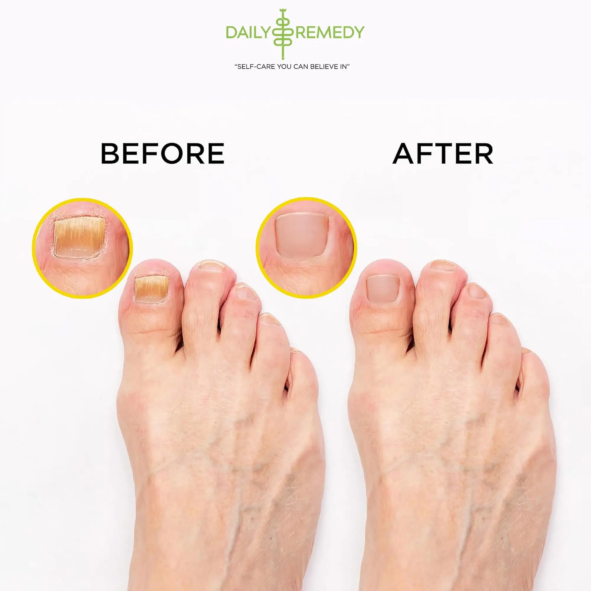 Citrus Detox Foot Soak with Epsom Salt - for Foot Callus, Immune Boost, Damaged Toenail DAILY REMEDY Au supplements