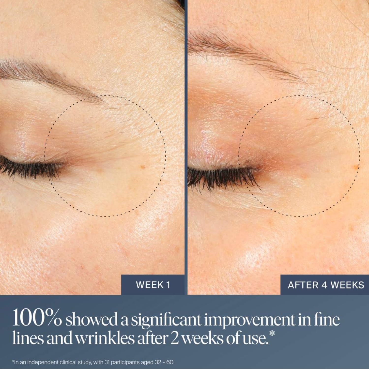 Summer Fridays Jet Lag Overnight Eye Serum - Nourishing Undereye Treatment for Dark Circles - Helps to Hydrate, Smooth, Firm & Depuff - Enriched with Glycerin to Lock in Moisture (0.5 Fl Oz) Summer Fridays Au supplements