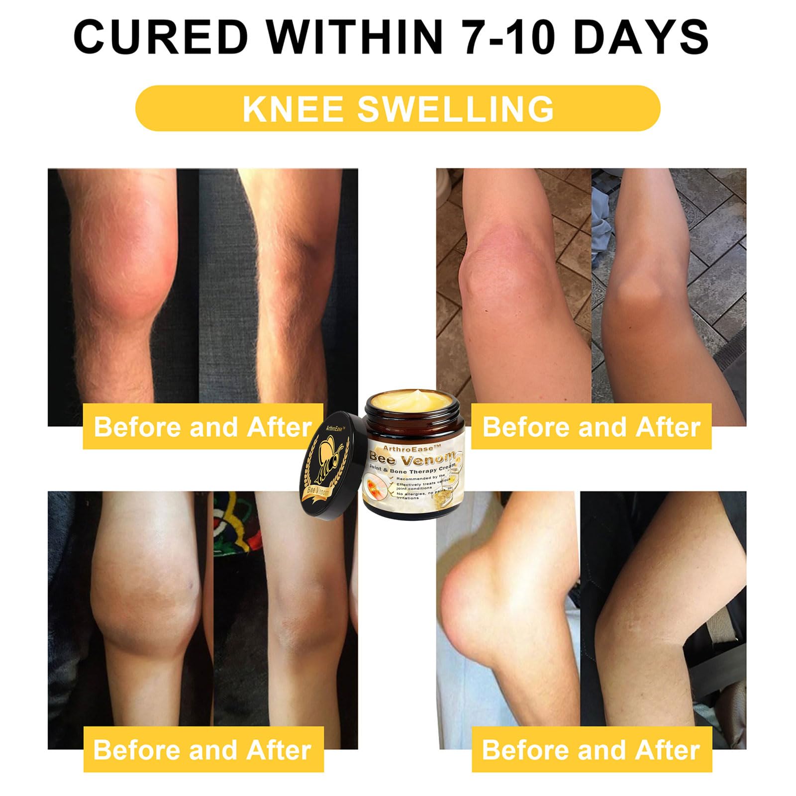 ArthroEase Bee Venom Joint and Bone Cream,ArthroEase Bee Venom Cream,Bee Venom Joint Gel,Effectively Relieve Joint discomfort (2) ADFIRE Au supplements