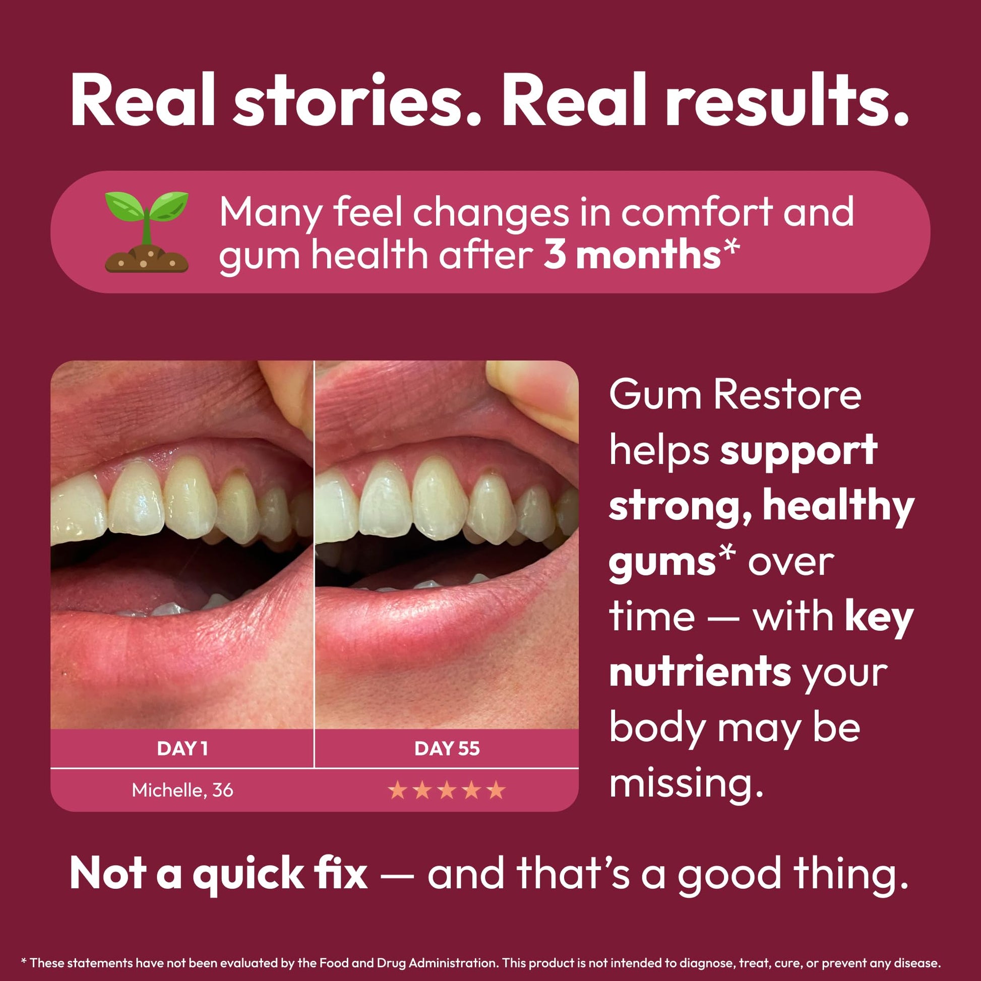 Strong Jaw Gum Restore - Gum Repair for Receding Gums | Teeth Magnesium Supplements, Oral Care, Remineralizing Dental Health Vitamins for Adults | 1 Month Supply, 180 Capsules, Made in USA Strong Jaw Au supplements