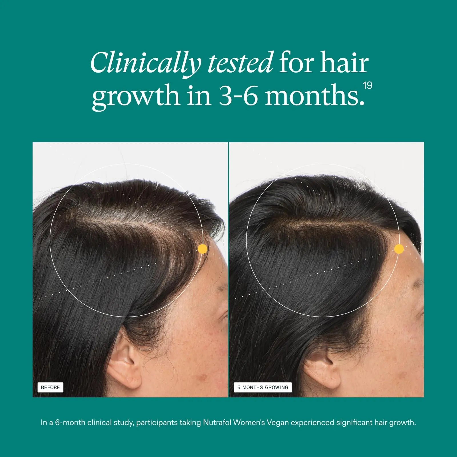 Nutrafol Women's Hair Growth Supplements, For Women 18-44 Years Old, Clinically Tested for Visibly Thicker, Stronger Hair, 100% Vegan Ingredients, Nutrafol Au supplements