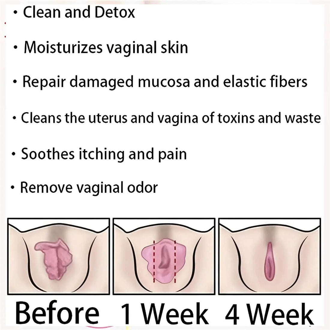 AnnieCare Instant Anti-Itch Detox Slimming Products, Annie Care Natural Detox Viginal Gel DASHENRAN Au supplements