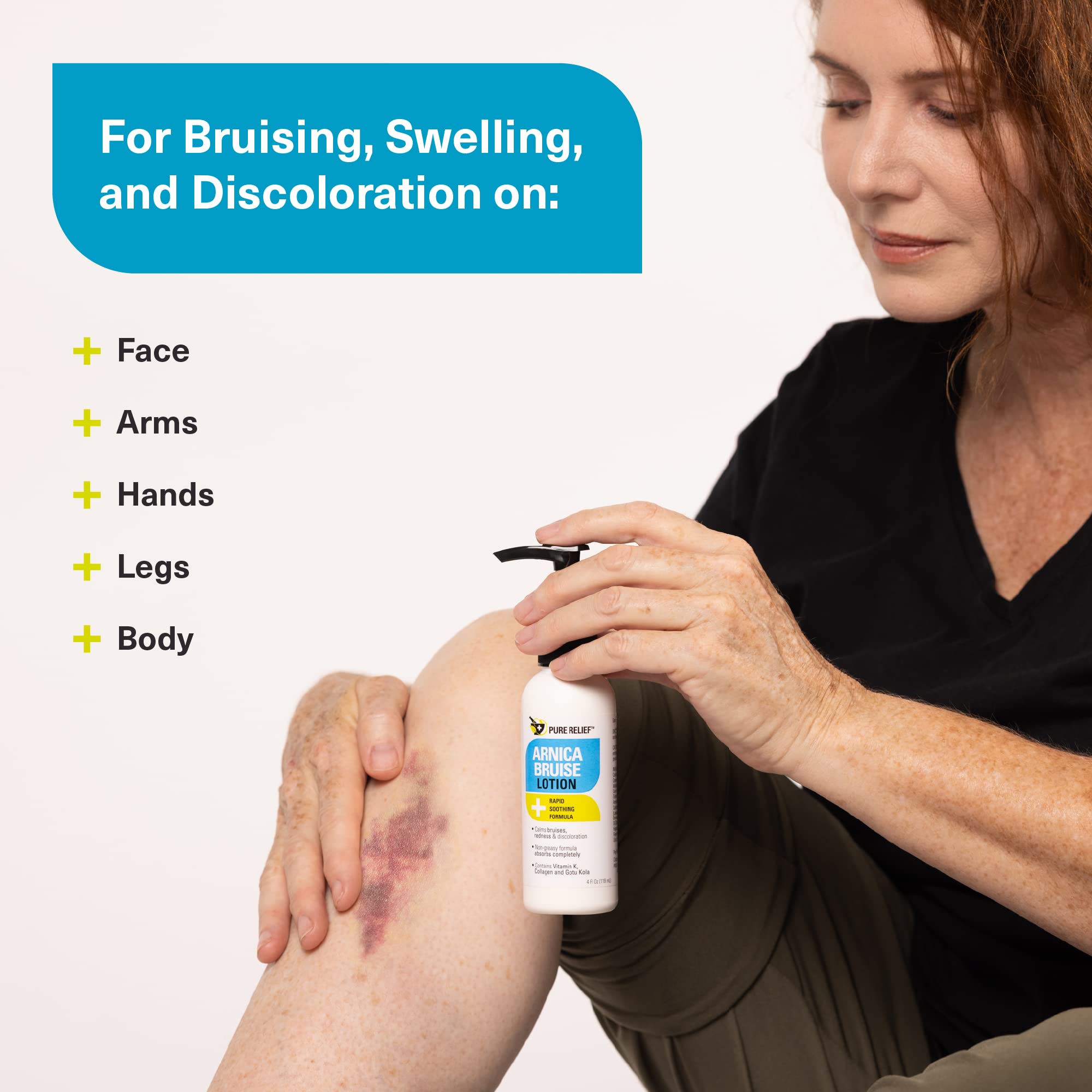 Pure Relief Arnica Bruise Relief Lotion for Bruising, Swelling, & Discoloration On Skin, Natural Skin Care Arnica Bruise Homeopathic Topical Bruise Cream W/Aloe Vera & Collagen, 4 Fl Oz (Pack of 3) Pure Relief Au supplements