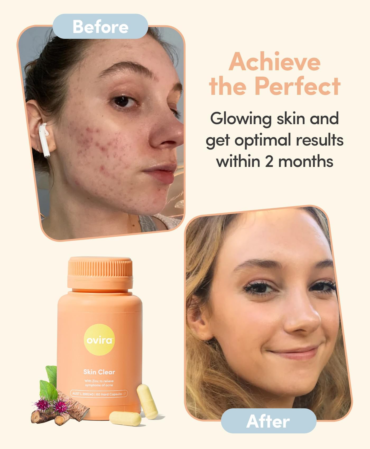 Ovira Skin Clear with ZINCBRIGHT - 60 Capsules for Clear and Glowing Skin | Rosacea & Hormonal Acne Treatment | Support Collagen Production | Acne Supplements for Women & Men - Pack of 2 Ovira Au supplements