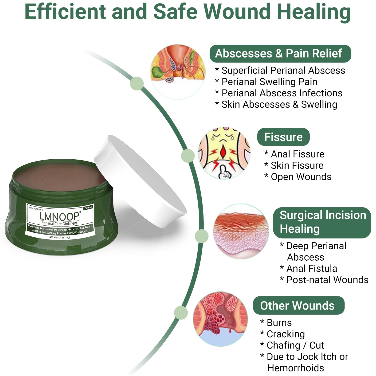 LMNOOP Perianal Repair Ointment: Treatments for Anal Fistula, Anal Fissure, Perianal Abscess, Rapid Relief from Pain, Burning, Itching, Swelling, Bleeding, and Discomfort by Jock Itch or Hemorrhoids LMNOOP Au supplements