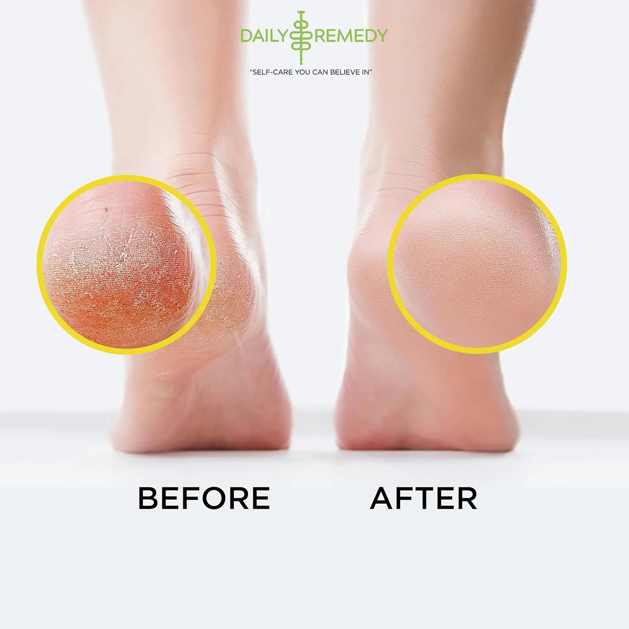 Citrus Detox Foot Soak with Epsom Salt - for Foot Callus, Immune Boost, Damaged Toenail DAILY REMEDY Au supplements