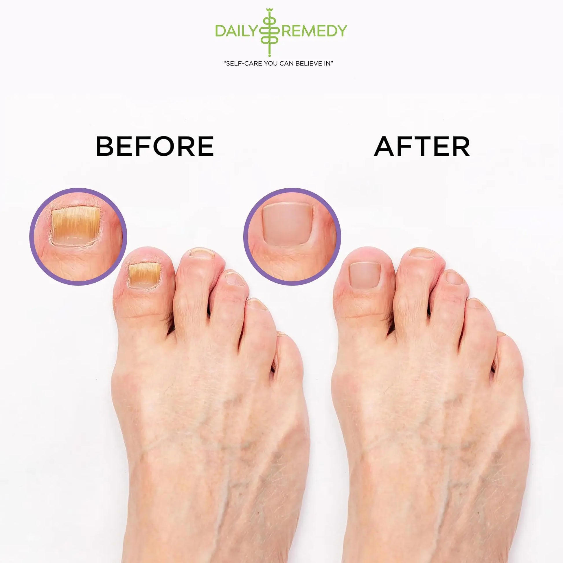 Calming Lavender Foot Soak with Epsom Salt, Made in USA, Foot Soak Soothes Sore Tired DAILY REMEDY Au supplements