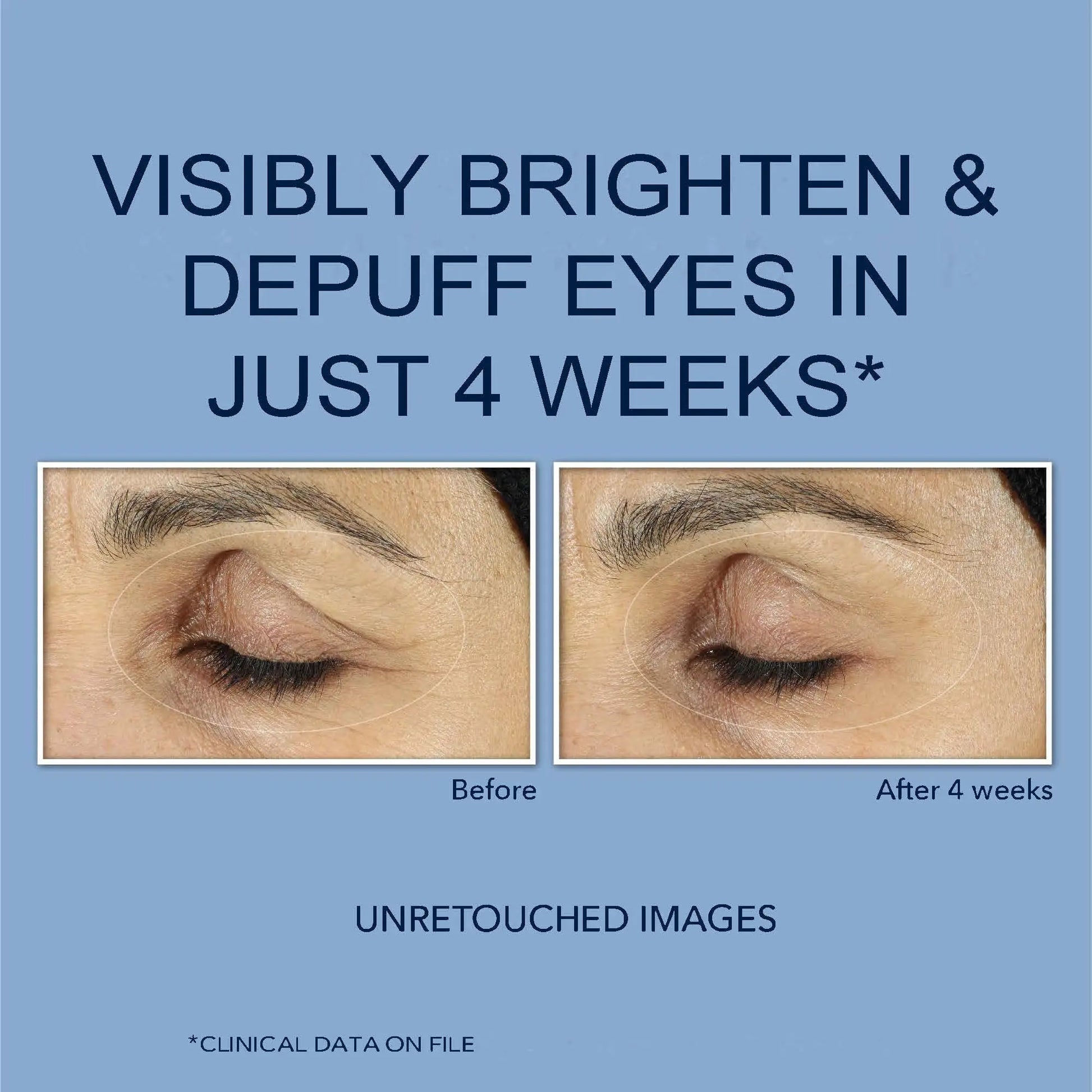 RoC Retinol Correxion Eye Cream Mini for Dark Circles & Puffiness, Daily Wrinkle RoC Au supplements