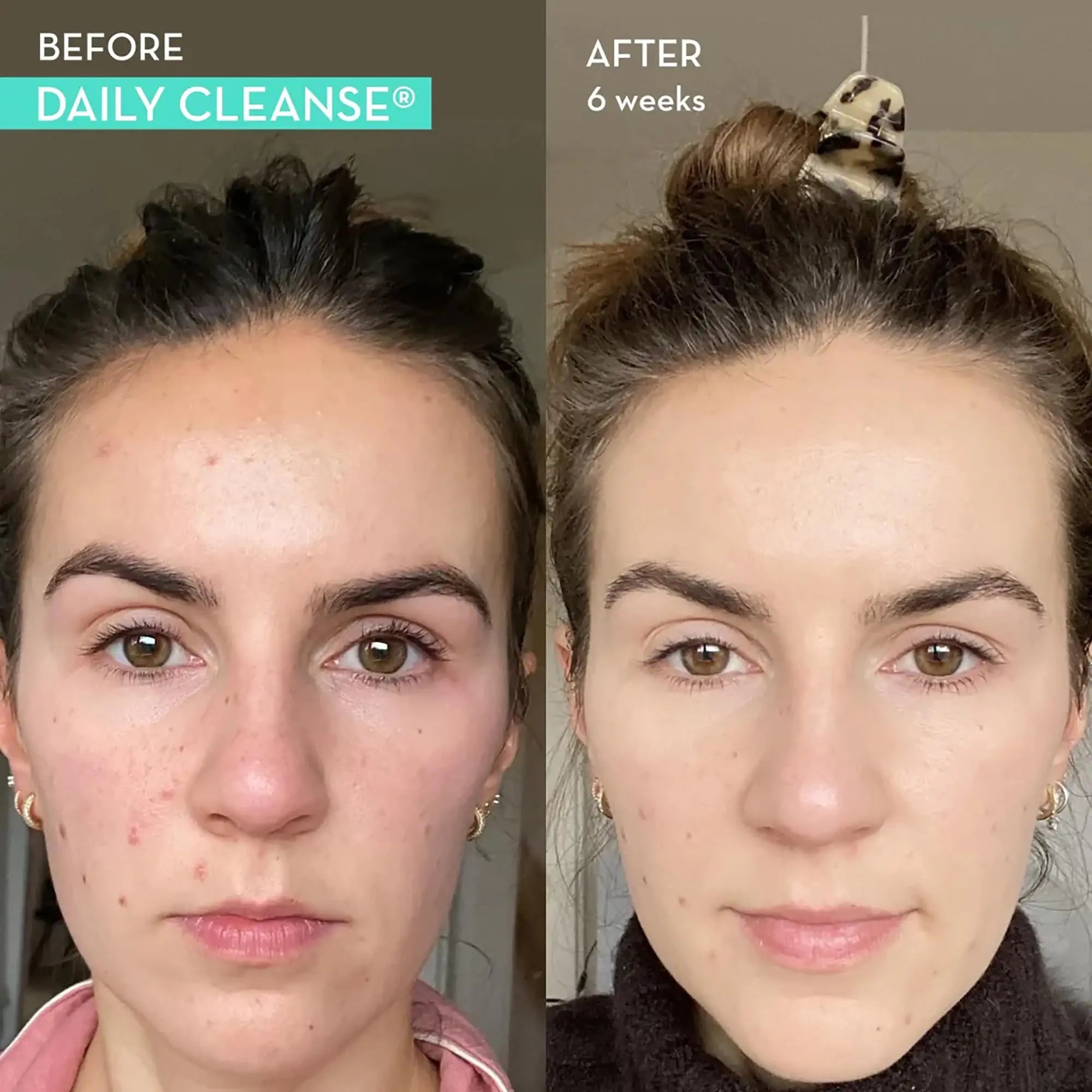 HUM Daily Cleanse Acne Supplements - Support for Clear Skin & Improved Digestion HUM Au supplements