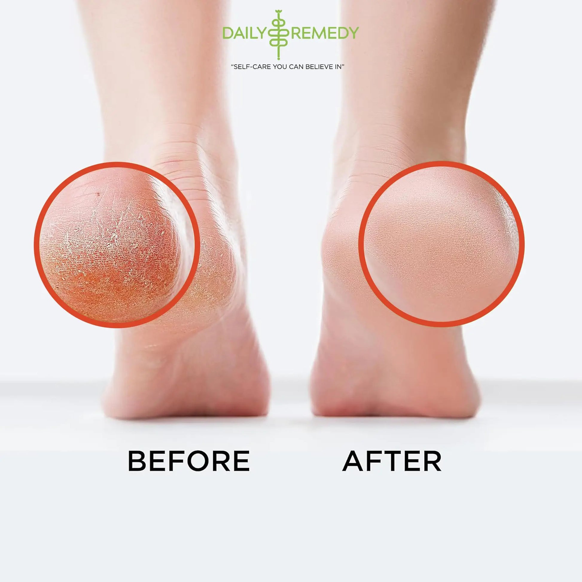 Muscle Relief Foot Soak with Epsom Salt, Made in USA, Soothe Foot Aches, Muscle Pain DAILY REMEDY Au supplements