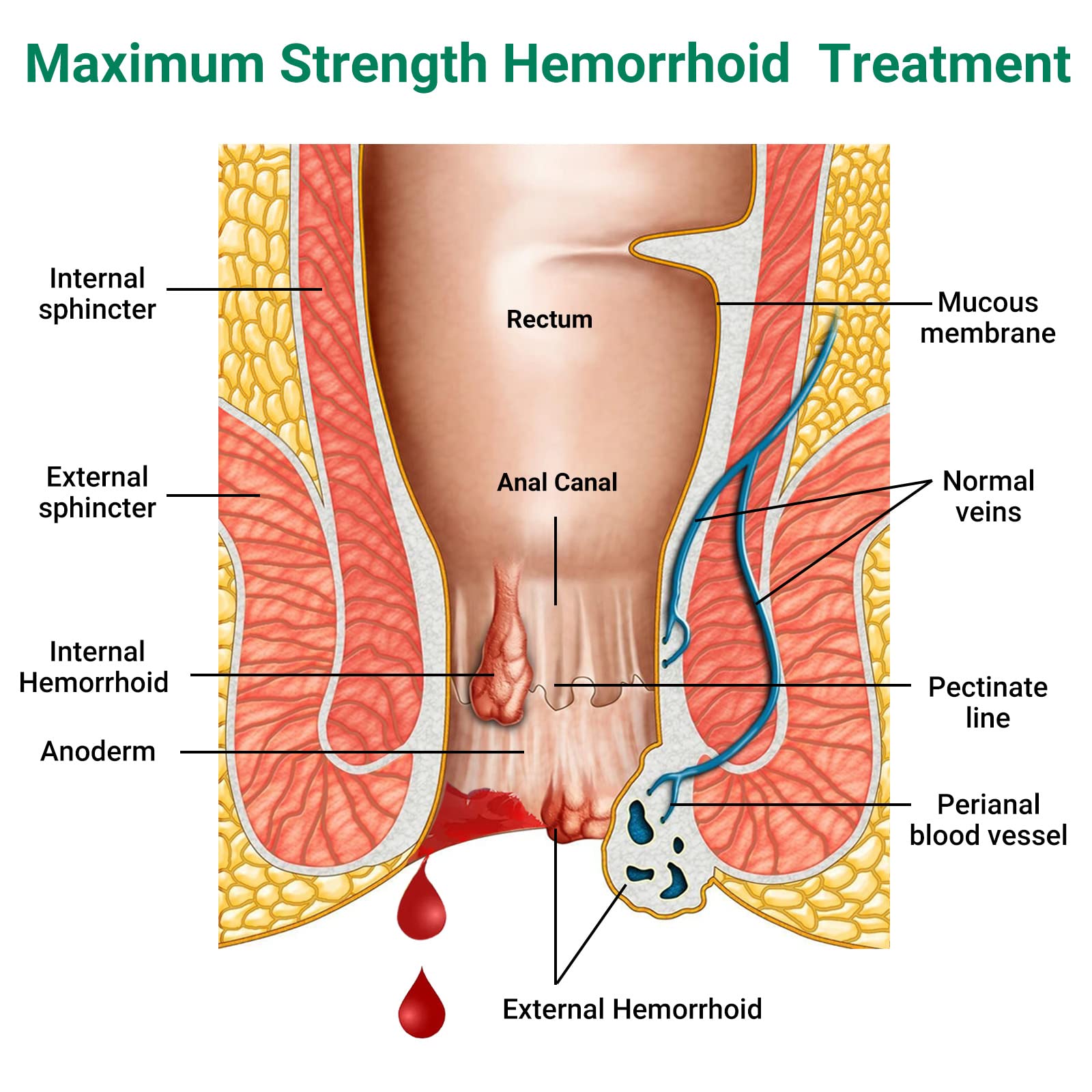 Hemorrhoid Treatment Ointment, Maximum Strength Treatment & Fast Relief for Pain, Itching, Burning, Swelling, Fissure, Bleeding, Discomfort, Long-Lasting Internal & External Hemorrhoid Cream, (2-Pack) LMNOOP Au supplements