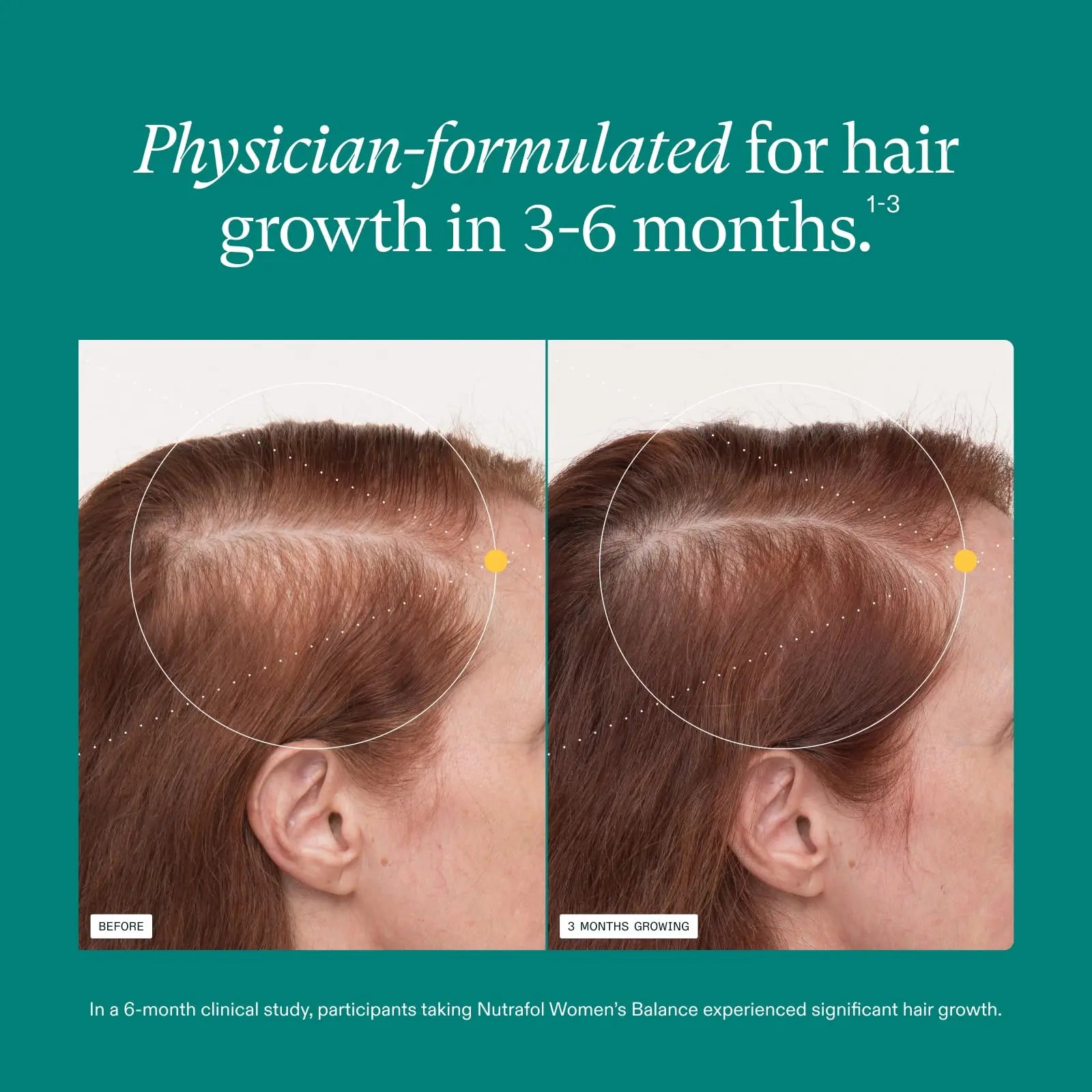 Nutrafol Women's Balance Hair Growth Supplements, Ages 45 and Up, Clinically Proven for Visibly Thicker Hair and Scalp Coverage, Dermatologist Recommended - 1 Month Supply Nutrafol Au supplements