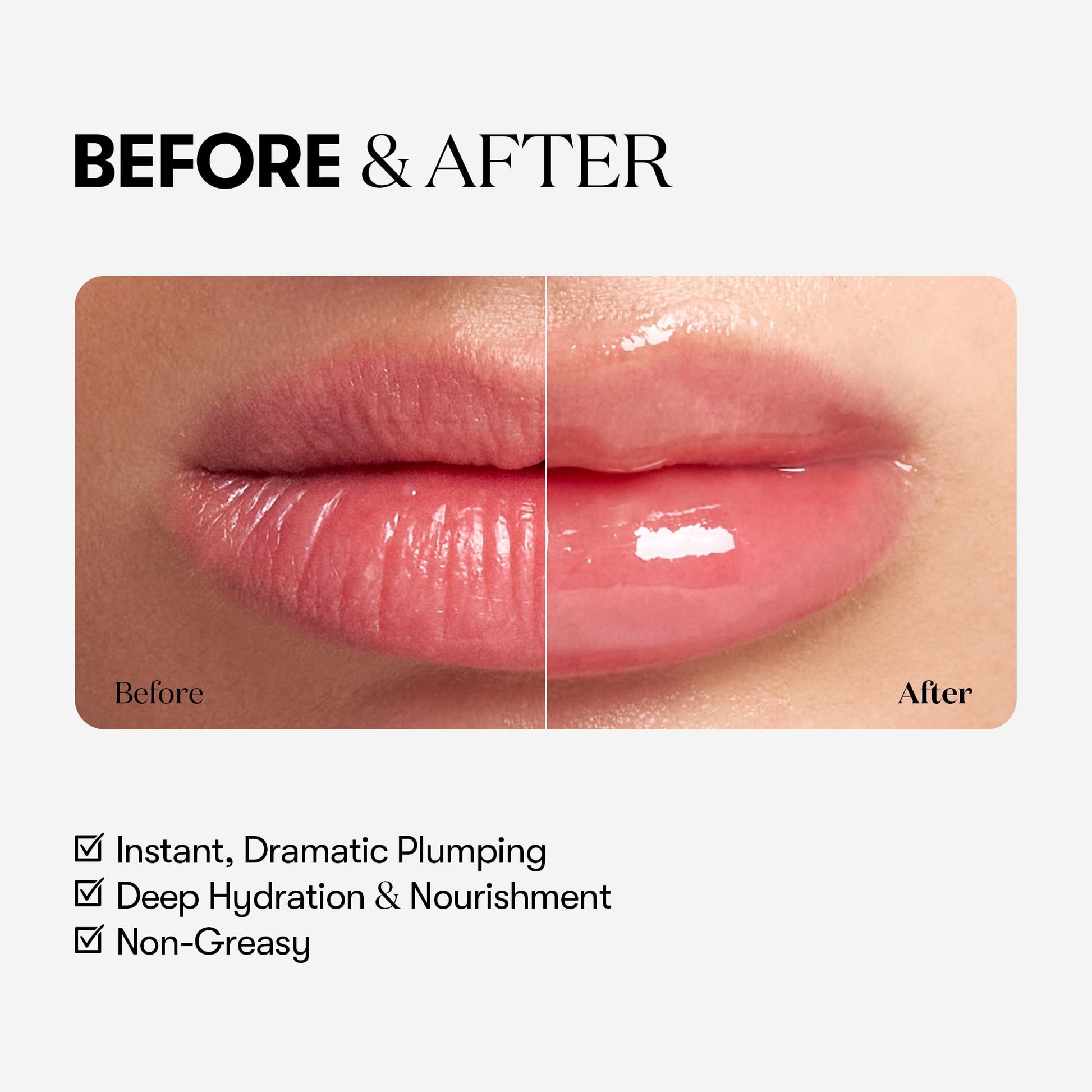 VTCOSMETICS Reedle Shot Lip Plumper, 0.15 oz (4.3 g), Moisturizing, Transparent, Lip Gloss, Fragrance-free, Korean Cosmetics (Expert) VT COSMETICS Au supplements