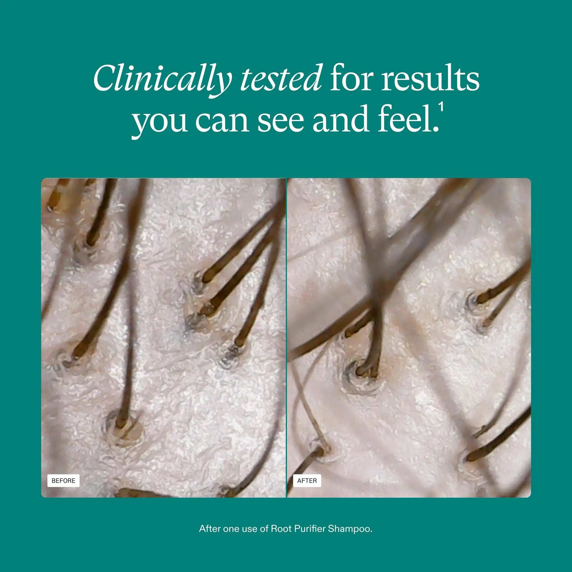 Nutrafol Shampoo, Cleanse and Hydrate Hair and Scalp, Improves Hair Volume, Strength and Texture, Physician-formulated for Thinning Hair, Color Safe, Sulfate Free - 8.1 Fl Oz Bottle Nutrafol Au supplements