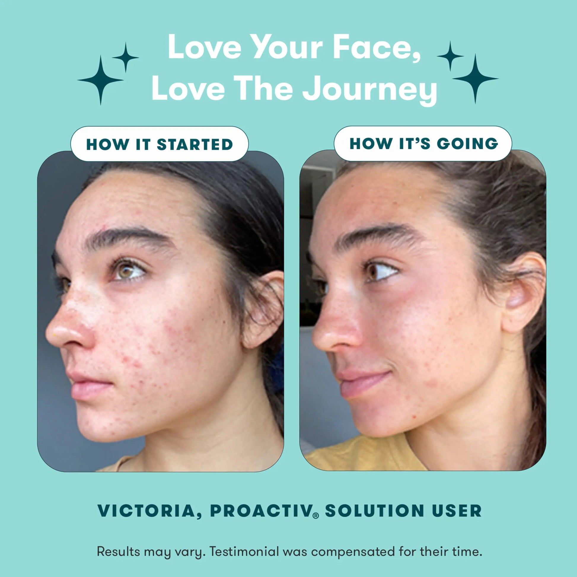 Proactiv 3 Step Acne Treatment - Benzoyl Peroxide Face Wash, Repairing Acne Spot Treatment for Face and Body Proactiv Au supplements