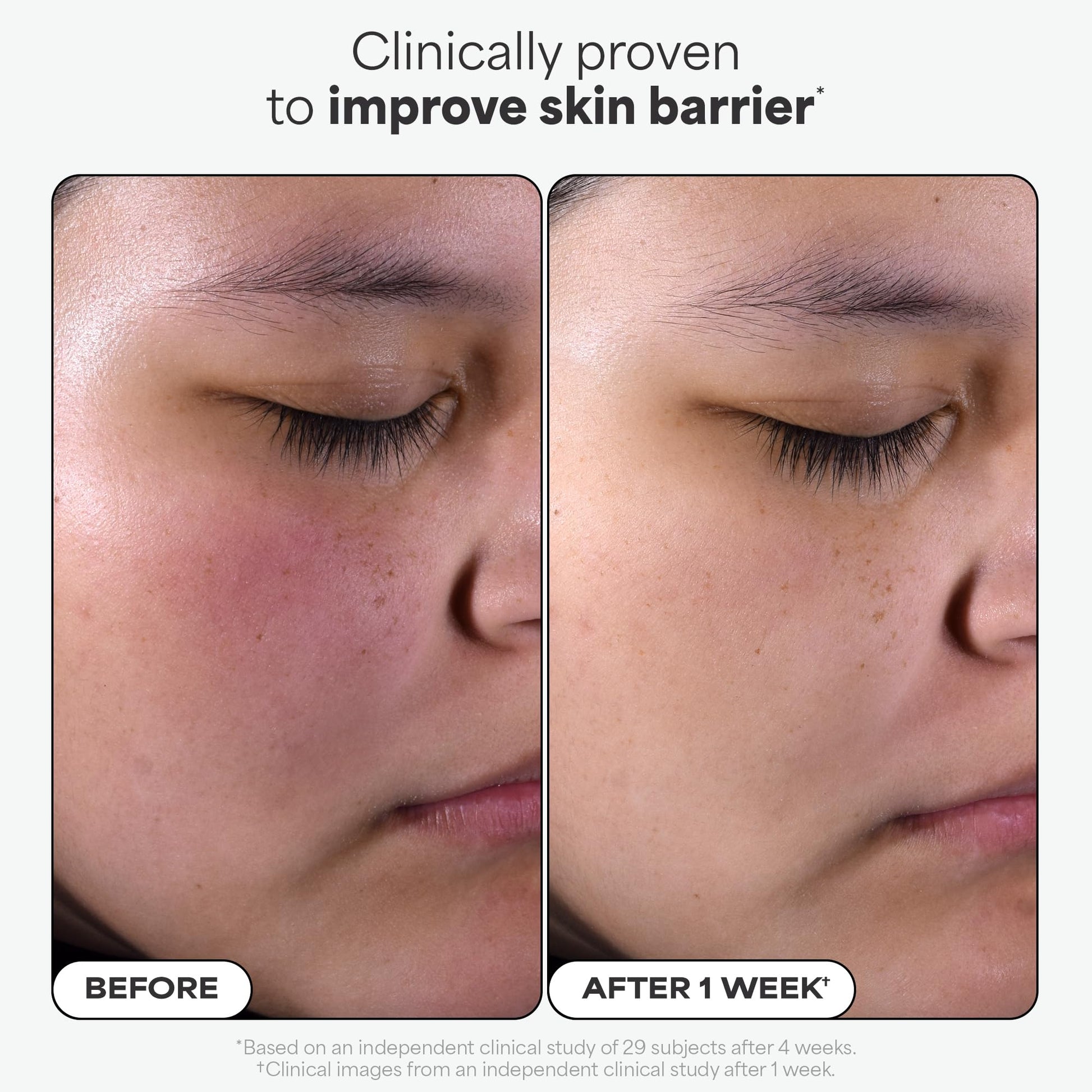 Paulas Choice--SKIN PERFECTING 2% BHA Liquid Salicylic Acid Exfoliant--Facial Exfoliant for Blackheads, Enlarged Pores, Wrinkles & Fine Lines, 4 oz Bottle Paula's Choice Au supplements