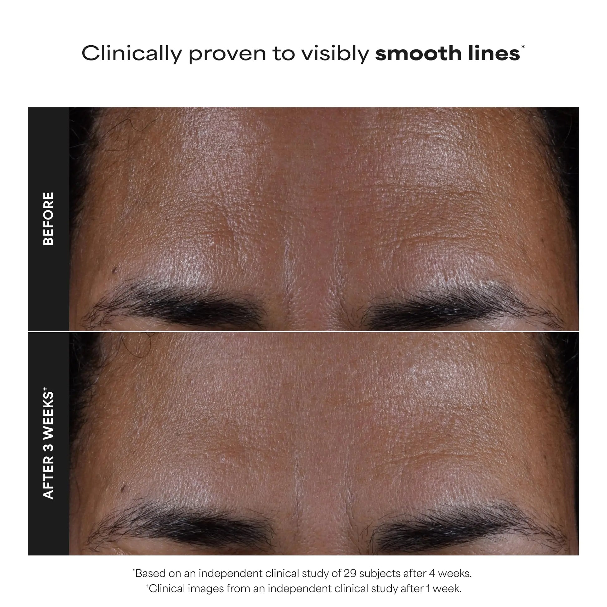 Paulas Choice--SKIN PERFECTING 2% BHA Liquid Salicylic Acid Exfoliant--Facial Exfoliant Paula's Choice Au supplements