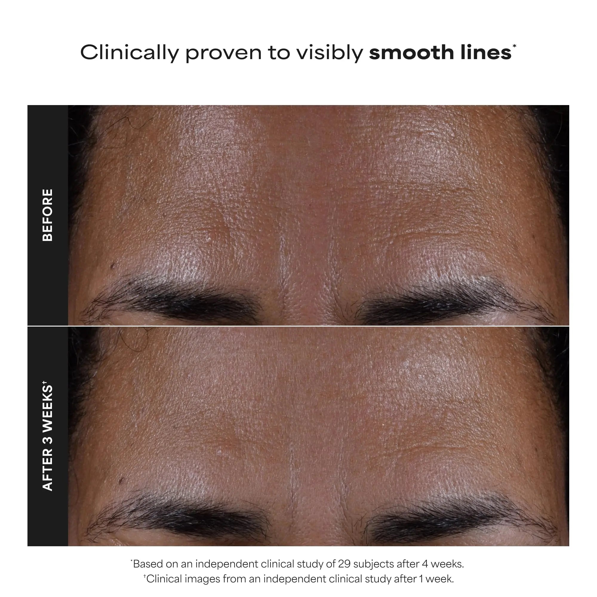 Paulas Choice--SKIN PERFECTING 2% BHA Liquid Salicylic Acid Exfoliant--Facial Exfoliant Paula's Choice Au supplements