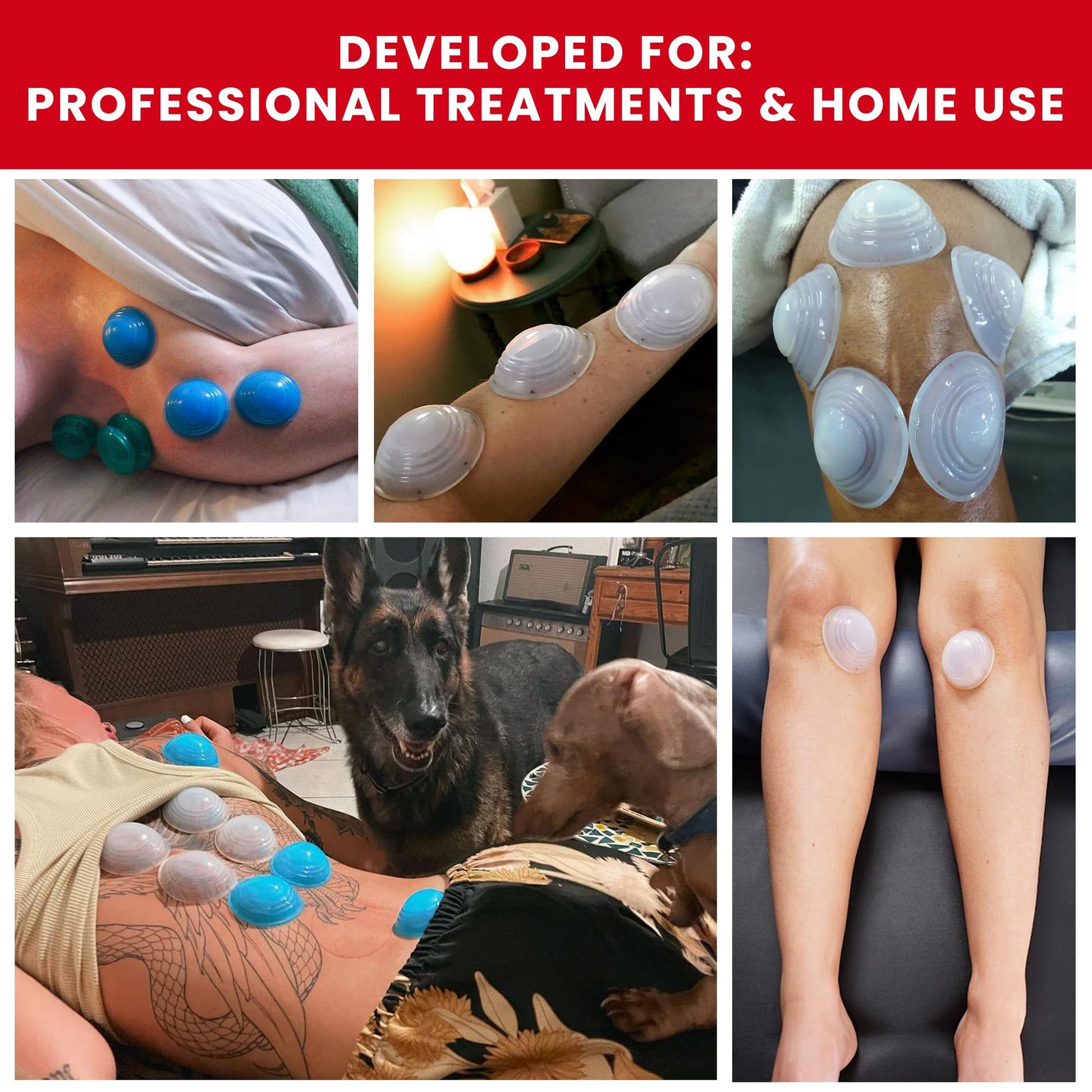 Lure Essentials Cupping Therapy Set 10 Professional Silicone Cupping Cups for Muscle Knots, Joints, Muscles, Arms and Feet Lure Essentials Au supplements