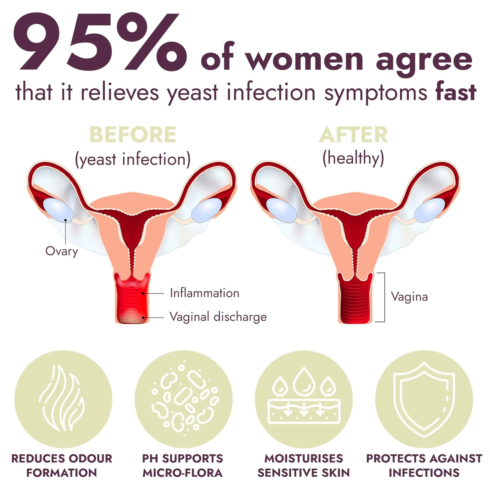 Yeast Infection Treatment for Women | Boric Acid Suppositories For Women | Helps Relieve Itching & Irritation | Vaginal Aid for Inflammation, Dryness & Watery Discharge | 12 Vaginal Suppositories Terramed Just Think Comfort Au supplements