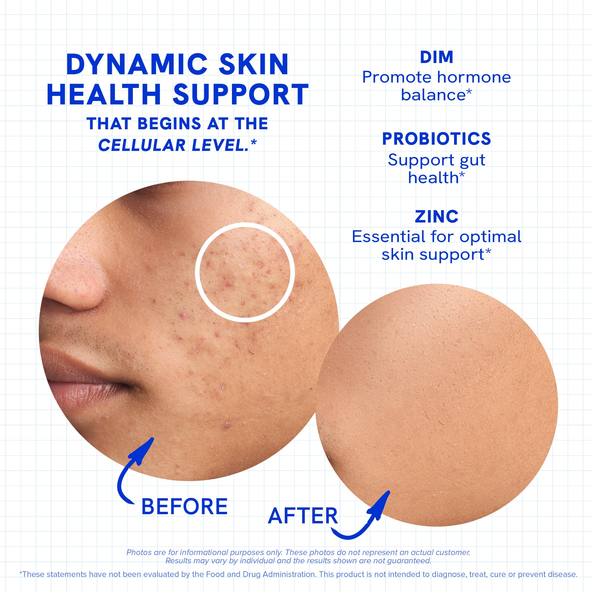Clear Skin Supplement with Zinc, DIM & Probiotics | 3-in-1 Balance, Glow & Health Skin Support | Triple Action Hyaluronic Acid, Niaciminide & Vitamins for Hormone, Complexion & Gut Support | 180 Ct SMNutrition Au supplements
